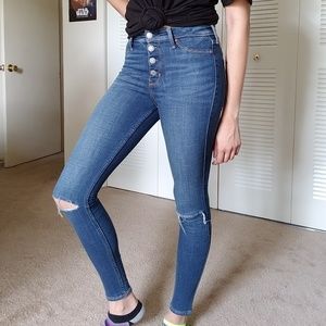 Button-down Skinny Jeans